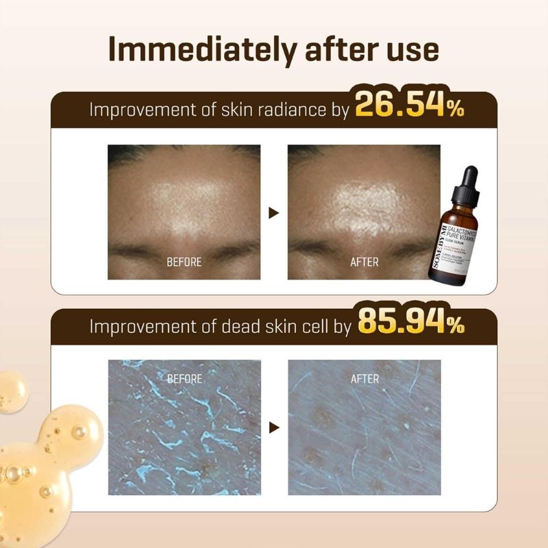 SOME BY MI Galactomyces Pure Vitamin C Glow Serum - 1.01Oz, 30ml - Korean Vitamin C Face Serum for Glow Glass Skin - Dark Spot Correcting Serum with Skin Texture and Elasticity Care - Korean Skin Care