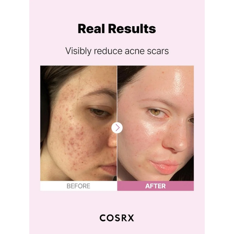 The Niacinamide 15 Serum (20ml) - Image 4