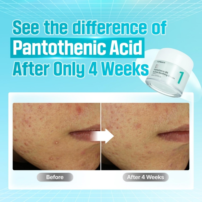 No.1 Pantothenic B5 Active Soothing Cream (80ml) - Image 5