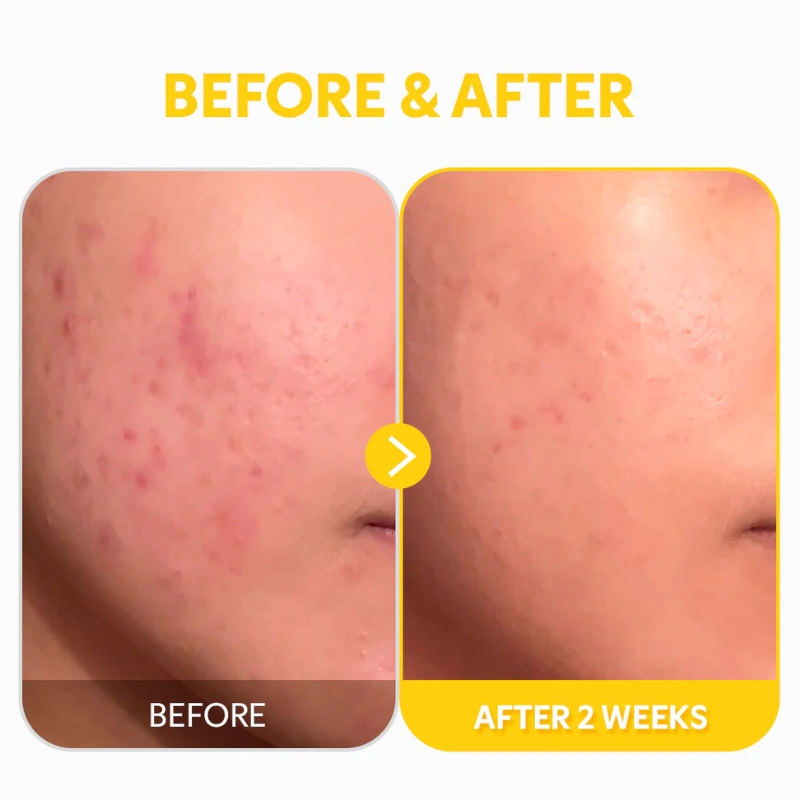 Pure Vitamin C 24% Serum (30ml) - Image 7
