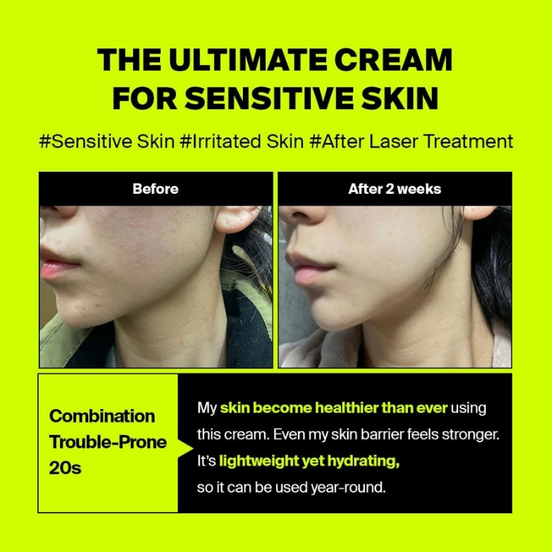Purcell PIXCELL BIOM™ After Laser Rebooting Cream for Probiotic Barrier Recovery with Niacinamide, Panthenol, Suitable for Sensitive Skin, 50ml, Korean Cosmetics Cyprus
