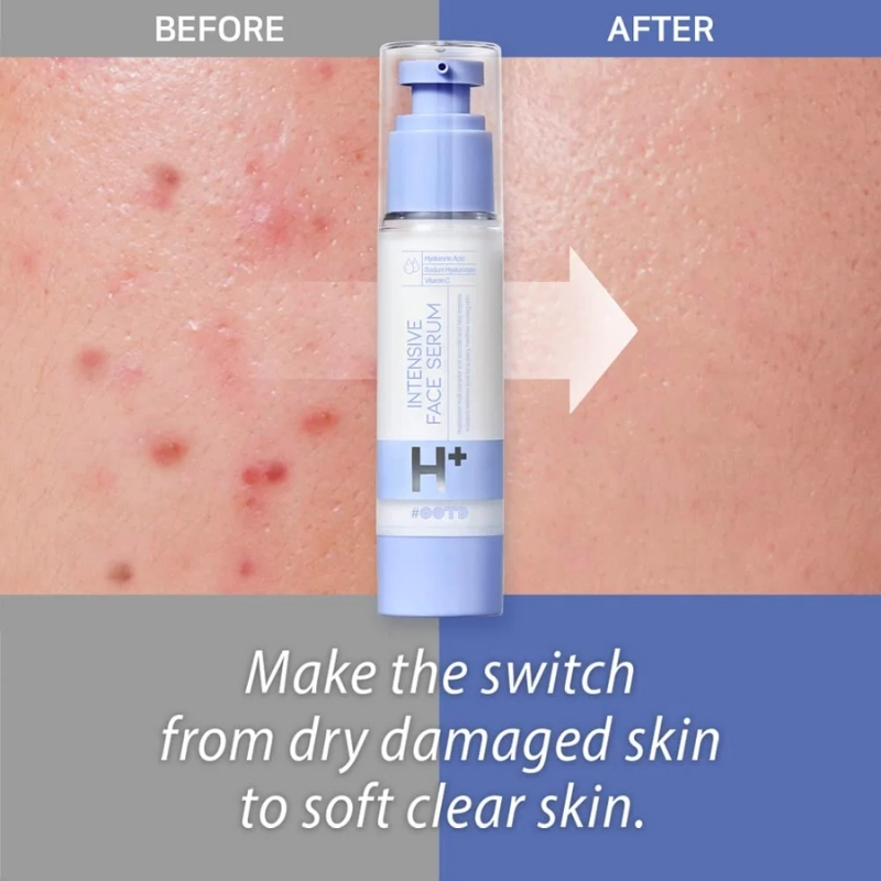 OOTD - Intensive Moisture Face Serum A.M