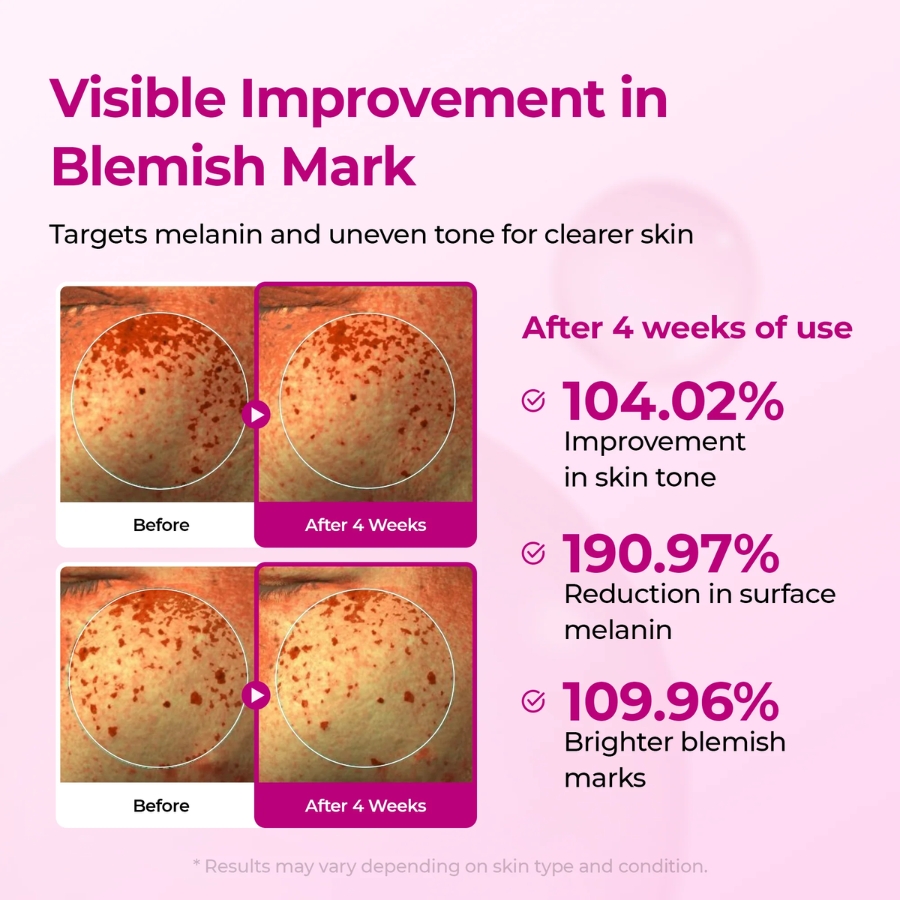 Dr. Melaxin Picotonic Shot Pigmentation Ampoule. Korean Cosmetics Cyprus, Just Cosmetics
