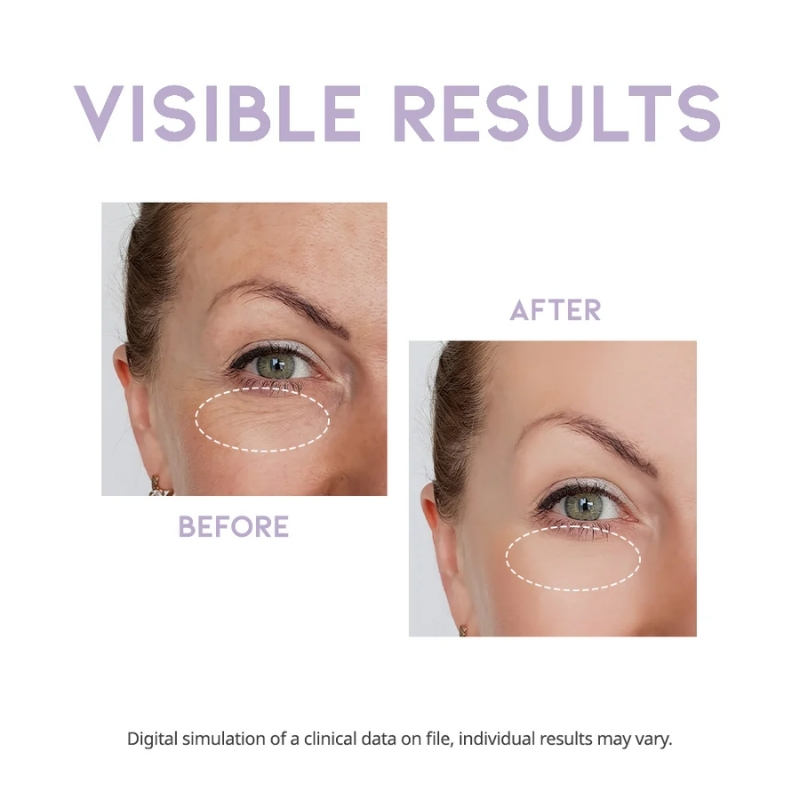 OOTD - Overnight Eye Cream P.M