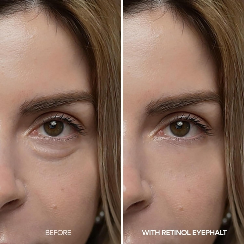 Dr.Melaxin - Eyephalt Retinol Eyebag Cream 10g