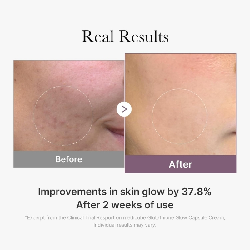 AGE-R Glutathione Glow Capsule Cream 50ml - Image 5