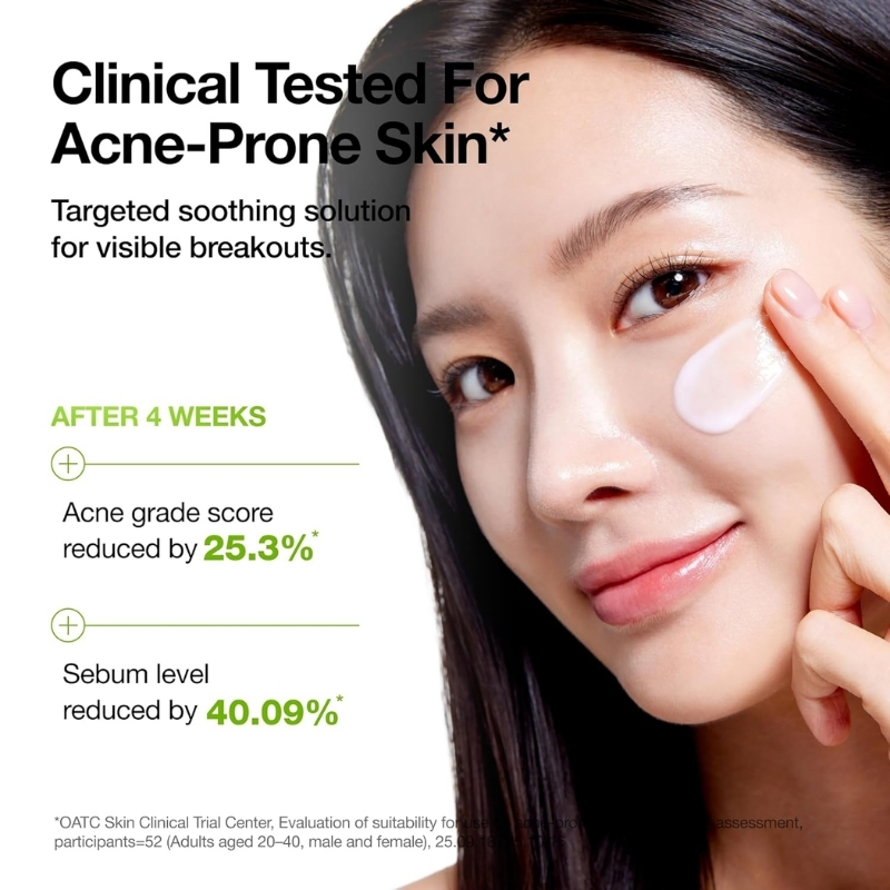 Close-up of a woman applying a skin patch to her cheek; headline reads 'Clinical Tested For Acne-Prone Skin' with 'After 4 Weeks' results: acne grade down 25.3%, sebum down 40.09%.