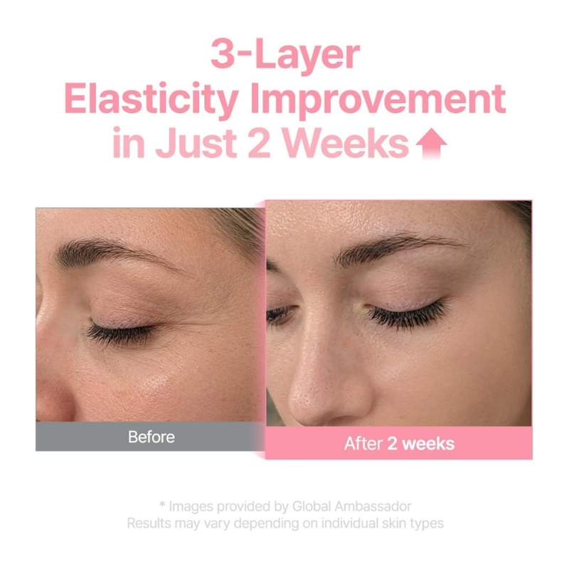 Multi PDRN Collagen EGF Serum (30ml) - Image 6