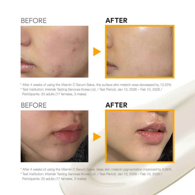 Vitamin C Serum Salve (10ml) - Image 7